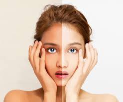 Надвор од белење: научен пристап на Synlotic Biotech за посветла и рамномерна кожа